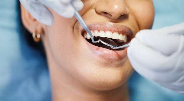 Best Emergency Dental Care for Broken or Chipped Teeth in Louisburg, KS